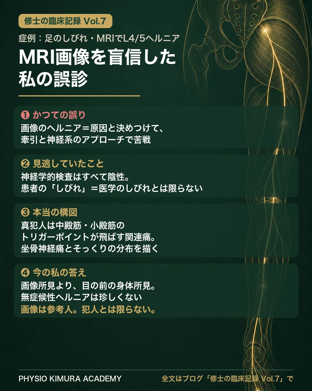 修士の臨床記録Vol.7 症例まとめ：MRIで L4/5 ヘルニアがあれば神経症状と決めつけ、牽引とスランプで苦戦。しかし神経学的所見は全陰性、本当の犯人は中・小殿筋のトリガーポイント関連痛だった。